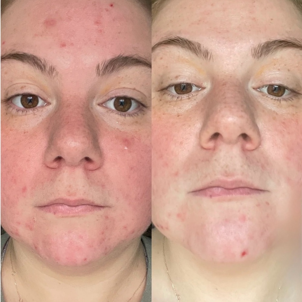 Byroe Celery AHA + LHA Serum - Picture 3 of 7